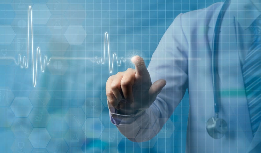 Кардиограмма, доктор