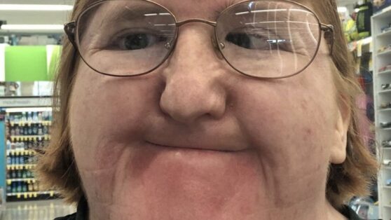 Блогерке с инвалидностью досталось от интернет-троллей