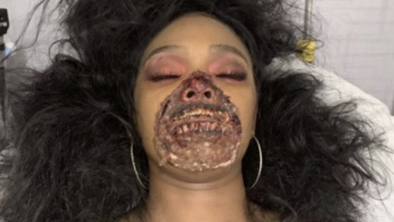 Актриса-зомби напугала врачей