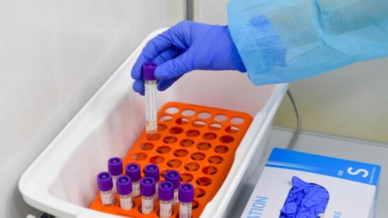 Российские тест-системы распознают «британский» коронавирус Российские тест-системы распознают «британский» коронавирус