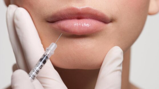 Блогерша рассказала о страшных последствиях увеличения губ