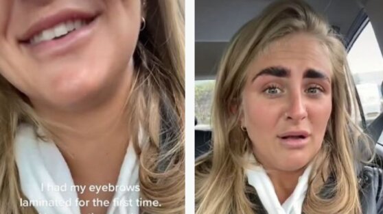 Девушка сделала ламинирование бровей, но результат довел ее до истерики