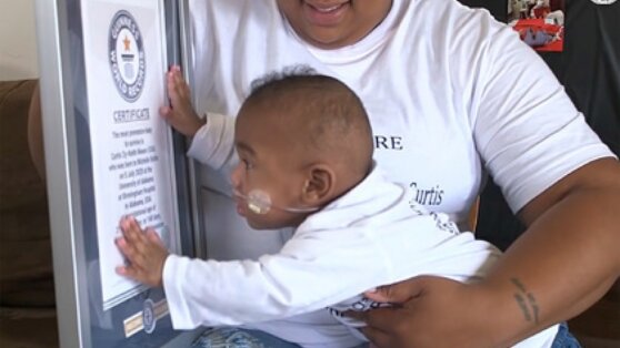 Мальчик родился недоношенным и попал в книгу рекордов Гиннесса