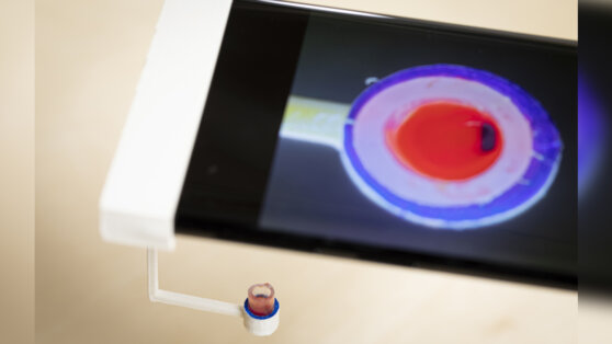 Свертываемость крови научились определять с помощью смартфона