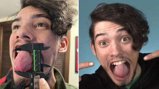 Американец попал в Книгу рекордов Гиннесса за самый толстый язык