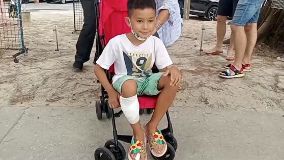 Мальчик 8 лет ударил акулу по носу и выжил