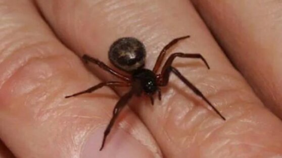 Из-за укуса паука тело женщины покрылось гематомами