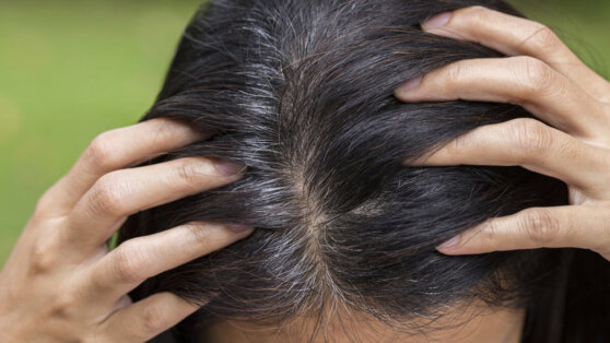 Врач объяснила, почему седые волосы появляются в молодом возрасте