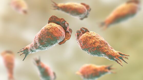 Женщина умерла после промывания носа водопроводной водой